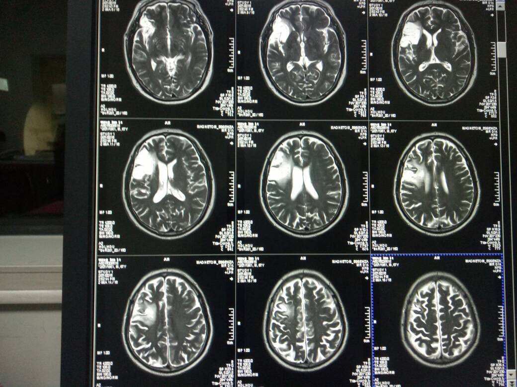 脑科学日报|NeuroImage:中国儿童标准脑结构发育图谱 - 知乎