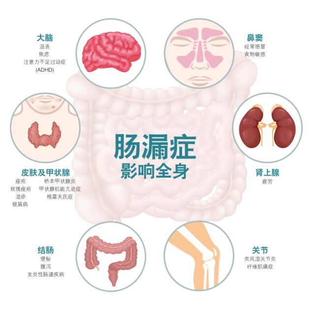 如何判断肠道是否健康