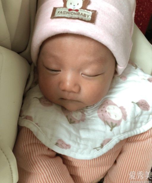 宝宝湿疹后,这些习惯要自查,别不当回事